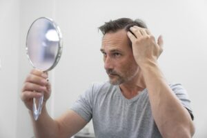 Hombre con alopecia androgénica examinándose el cuero cabelludo