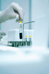 Mano con guante de laboratorio sosteniendo un tubo de ensayo con líquido azul, en el contexto de una analítica de sangre