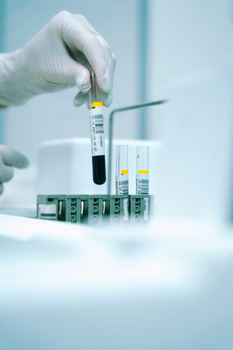 Mano con guante de laboratorio sosteniendo un tubo de ensayo con líquido azul, en el contexto de una analítica de sangre