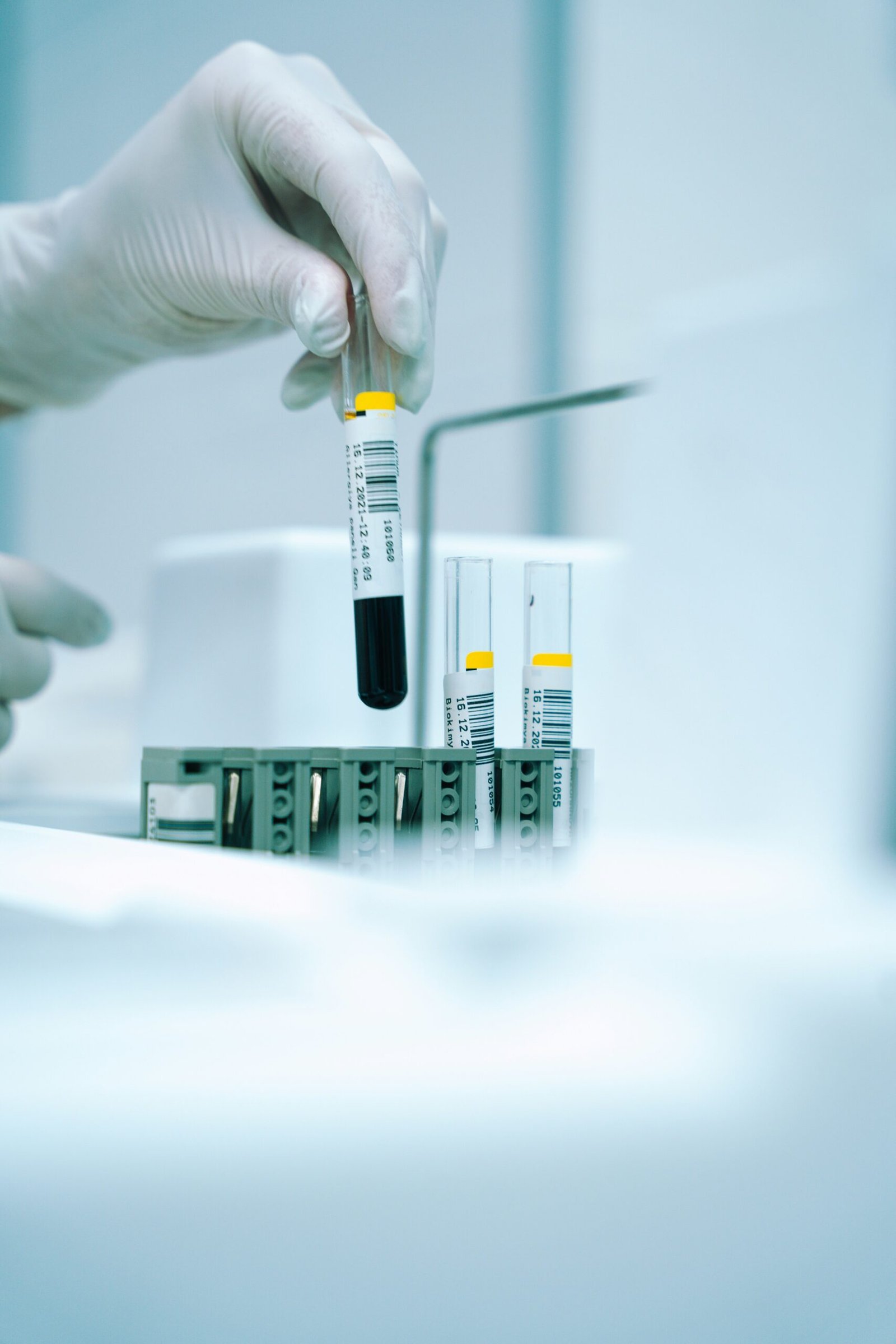 Mano con guante de laboratorio sosteniendo un tubo de ensayo con líquido azul, en el contexto de una analítica de sangre